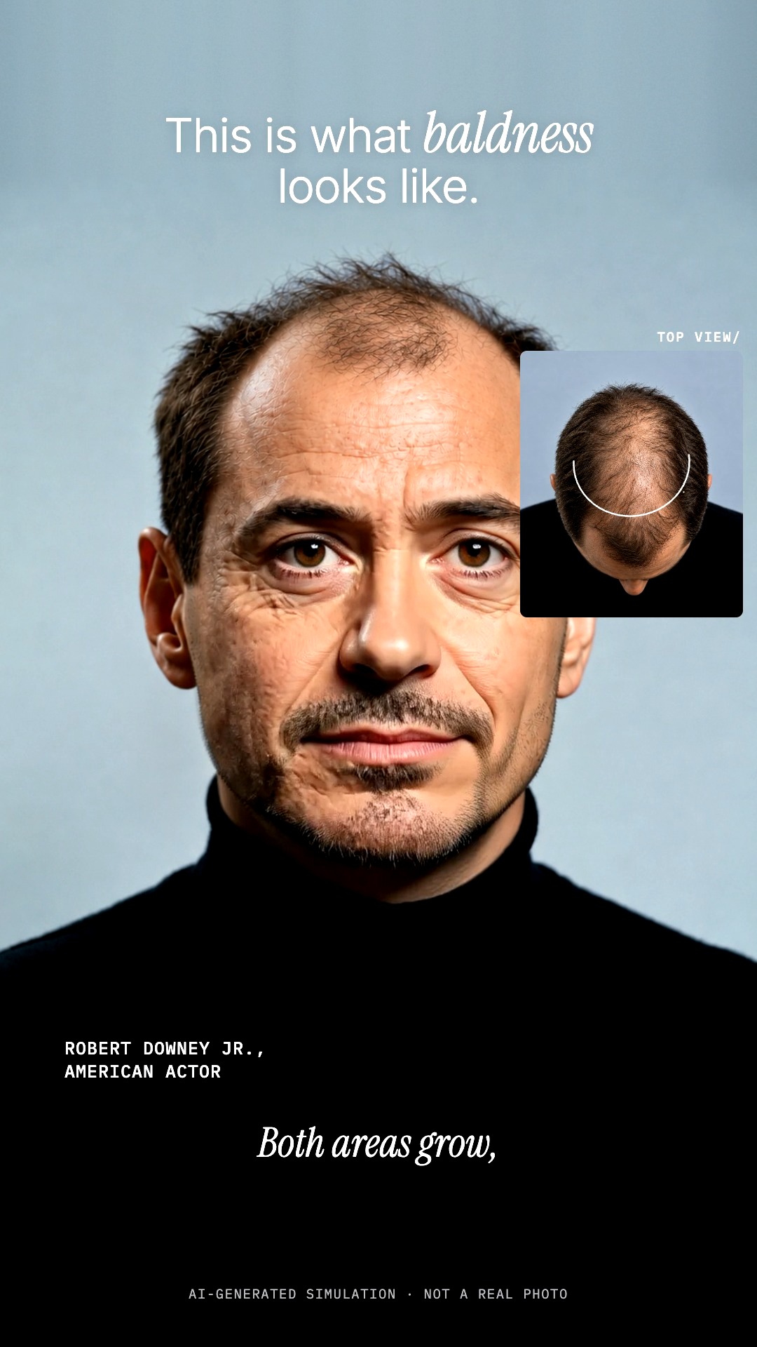 Hermest Hair Clinic | Hair Transplant Turkey Istanbul fotoğraf 5