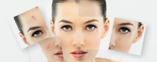 Medlay Güzellik, Kıl tekniği kaş, Dövme silme, Leke tedavisi fotoğraf 2