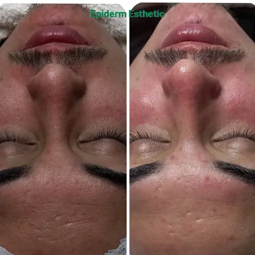Sermin erge güzellik salonu fotoğraf 1