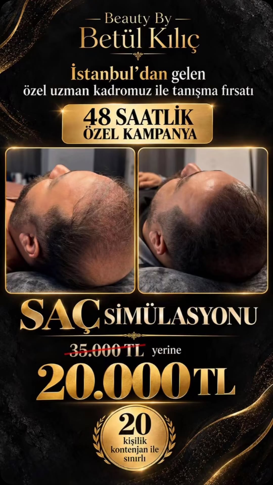Betül Kılıç Estetik,Güzellik ve Saç Simülasyon Merkezi fotoğraf 8