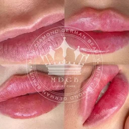 Miss Diamond German Beauty fotoğraf 1