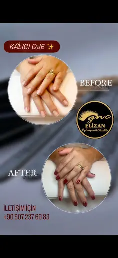Elizan Güzellik ve Lazer Epilasyon Merkezi fotoğraf 1
