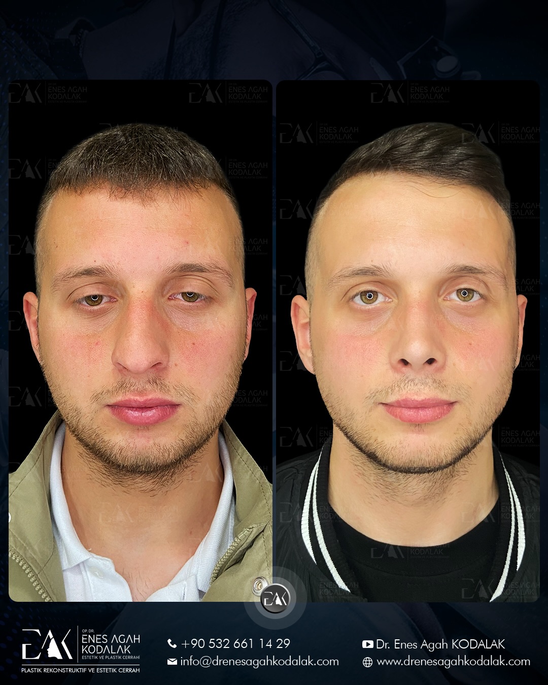 Op. Dr. Enes Agah Kodalak | Trabzon Estetik ve Plastik Cerrahi fotoğraf 6