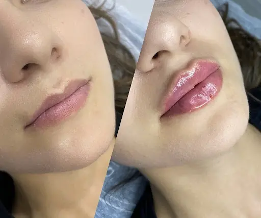 Seratonin Güzellik & Sağlıklı Yaşam fotoğraf 1