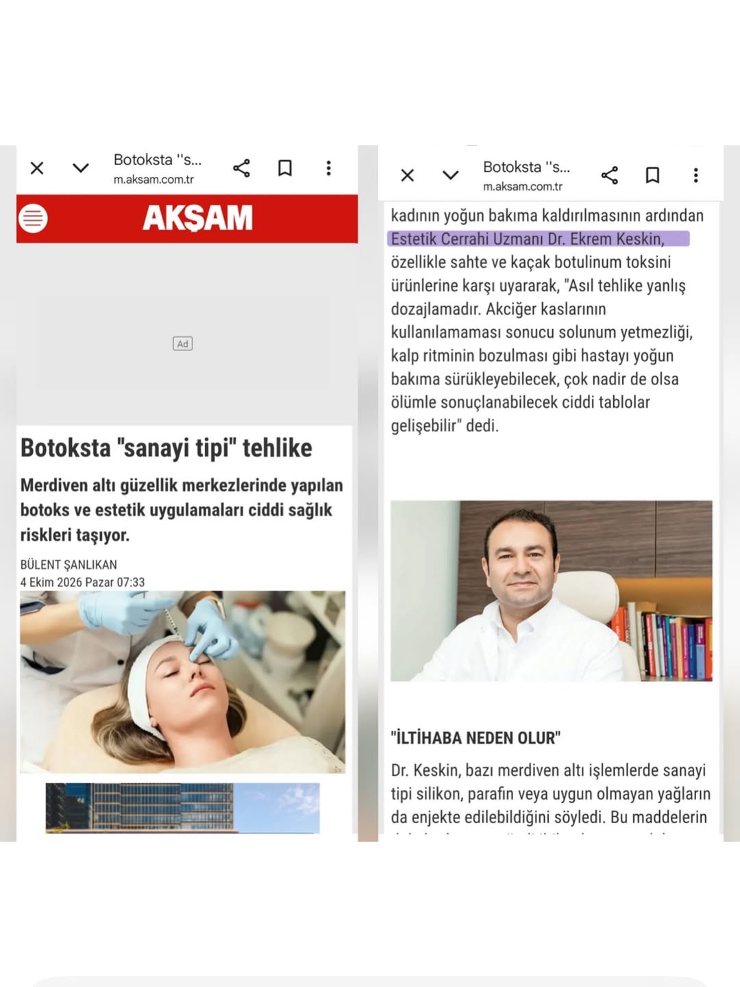 Burun Estetiği- Liposuction- Meme Estetiği-Karın germe -Op.Dr Ekrem KESKİN fotoğraf 3