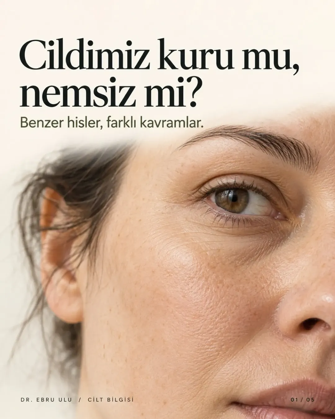 DR. EBRU ULU | Dolgu - Botoks - Lazer Epilasyon - Bölgesel İncelme - Altın İğne - Leke Tedavisi fotoğraf 3