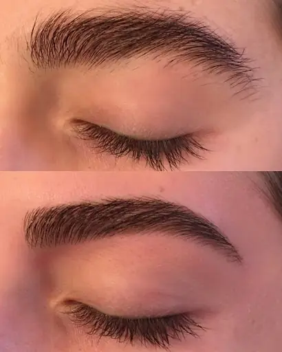 Kübra Deniz Beauty Center fotoğraf 1