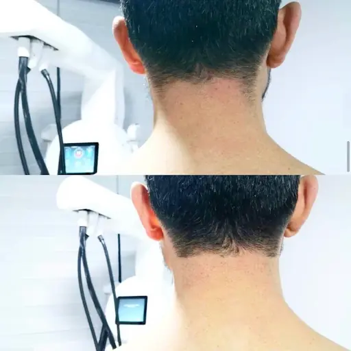 LAVİNİAVİP GÜZELLİK MERKEZİ fotoğraf 1