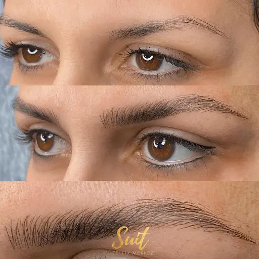 Bursa Suit Güzellik Merkezi fotoğraf 1